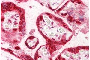 Anti-HMGB3 antibody IHC staining of human placenta. (HMGB3 抗体  (AA 150-200))