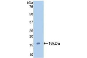 Detection of Recombinant GAL7, Human using Monoclonal Antibody to Galectin 7 (GAL7) (LGALS7 抗体  (AA 1-136))