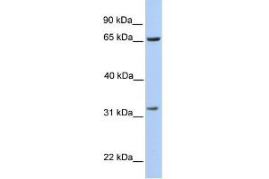 WB Suggested Anti-PBK Antibody Titration:  0. (PBK 抗体  (N-Term))