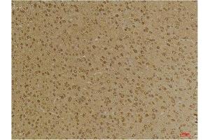 Immunohistochemistry (IHC) analysis of paraffin-embedded Mouse Brain Tissue using GABA A Receptor gamma2 Rabbit Polyclonal Antibody diluted at 1:200. (GABRG2 抗体)
