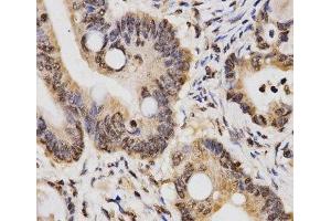 Immunohistochemistry (Paraffin-embedded Sections) (IHC (p)) image for anti-Histone 3 (H3) (2meLys14) antibody (ABIN7261231)