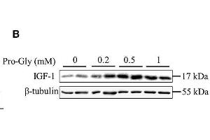 Western Blotting (WB) image for anti-Tubulin, beta (TUBB) (AA 61-160) antibody (ABIN706721)