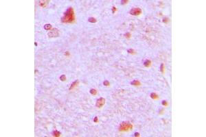 Immunohistochemical analysis of ARNT2 staining in human brain formalin fixed paraffin embedded tissue section. (ARNT2 抗体  (N-Term))