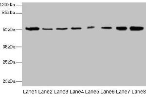 Western blot All lanes: PGS1 antibody at 2 μg/mL Lane 1: Mouse liver tissue Lane 2: Hela whole cell lysate Lane 3: Jurkat whole cell lysate Lane 4: HepG2 whole cell lysate Lane 5: THP-1 whole cell lysate Lane 6: Mouse spleen tissue Lane 7: Mouse thymus tissue Lane 8: Mouse kidney tissue Secondary Goat polyclonal to rabbit IgG at 1/10000 dilution Predicted band size: 63, 52, 38, 6 kDa Observed band size: 52 kDa (PGS1 抗体  (AA 110-400))