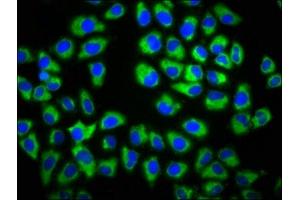 Immunofluorescence staining of Hela cells with ABIN7154478 at 1:133, counter-stained with DAPI. (GAS1 抗体  (AA 248-318))