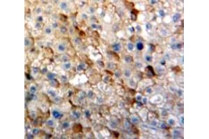 Used in DAB staining on fromalin fixed paraffin-embedded Liver tissue (IGSF1 抗体  (AA 1008-1227))