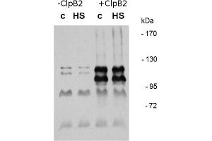 Image no. 2 for anti-ClpB2 Gene Product (CLPB2) antibody (ABIN334578) (CLPB2 抗体)