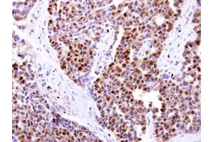 Immunohistochemistry (IHC) image for anti-Deoxycytidine Kinase (DCK) (Center) antibody (ABIN2856517)