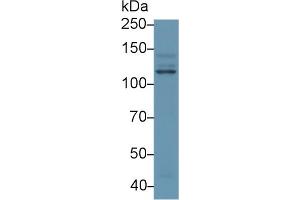 Western blot analysis of Human HeLa cell lysate, using Human PIK3Cb Antibody (1 µg/ml) and HRP-conjugated Goat Anti-Rabbit antibody ( (PIK3CB 抗体  (AA 524-703))