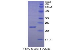 SDS-PAGE analysis of Goat Interleukin 1 alpha Protein. (IL1A 蛋白)