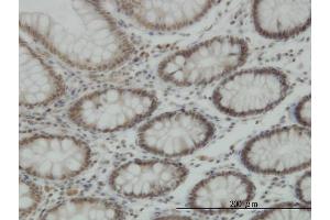 Immunoperoxidase of monoclonal antibody to KDM5B on formalin-fixed paraffin-embedded human colon. (KDM5B 抗体  (AA 231-319))