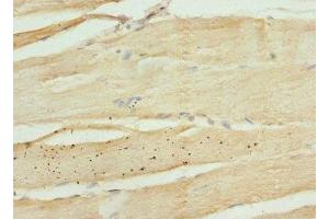 Immunohistochemistry of paraffin-embedded human skeletal muscle tissue using ABIN7157611 at dilution of 1:100 (KIF1B 抗体  (AA 1547-1816))