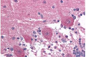 Human Brain, Cerebellum (formalin-fixed, paraffin-embedded) stained with PAX3 antibody ABIN214133 at 5 ug/ml followed by biotinylated goat anti-rabbit IgG secondary antibody ABIN481713, alkaline phosphatase-streptavidin and chromogen. (Paired Box 3 抗体  (AA 400-449))
