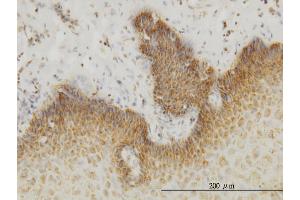 Immunoperoxidase of monoclonal antibody to INSRR on formalin-fixed paraffin-embedded human esophagus. (INSRR 抗体  (AA 651-760))