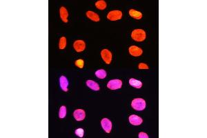 Immunofluorescence analysis of C6 cells using Symmetric DiMethyl-Histone H3-R2 Rabbit pAb (ABIN3016053, ABIN3016054, ABIN3016055, ABIN1680220 and ABIN6219534) at dilution of 1:100 (40x lens).