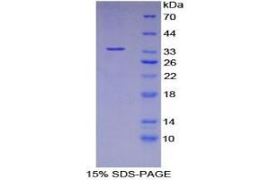 SDS-PAGE analysis of Human ASM Protein. (SMPD1 蛋白)