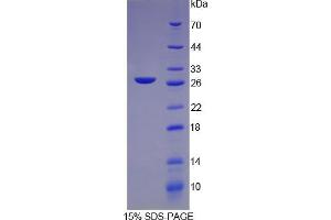 SDS-PAGE analysis of Rat C-Reactive Protein. (CRP 蛋白)