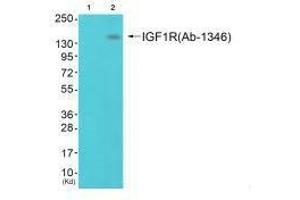 Western blot analysis of extracts from 293 cells (Lane 2), using IGF1R (Ab-1346) antiobdy. (IGF1R 抗体  (Tyr1346))