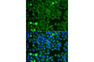 Immunofluorescence analysis of A549 cell using GBA3 antibody. (GBA3 抗体)