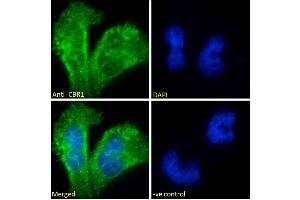 Immunofluorescence (IF) image for anti-Carbonyl Reductase 1 (CBR1) (C-Term) antibody (ABIN184784)