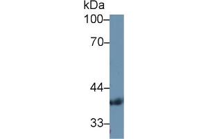 Western Blot; Sample: Human Serum; Primary Ab: 1µg/ml Rabbit Anti-Human PDHb Antibody Second Ab: 0. (PDHB 抗体  (AA 31-341))