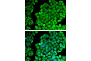 Immunofluorescence (IF) image for anti-Cyclin D2 (CCND2) antibody (ABIN1875413) (Cyclin D2 抗体)
