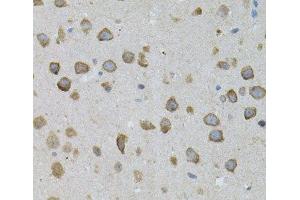Immunohistochemistry of paraffin-embedded Mouse brain using ASAH2 Polyclonal Antibody (ASAH2 抗体)