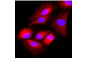 Immunofluorescence of human A549 cells stained with Hoechst 33342 (Blue) and monoclonal anti-human FUS2 antibody (1:500) with Texas Red (red). (FUS2/NAA80 (AA 1-308) 抗体)