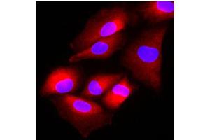 Immunofluorescence of human A549 cells stained with Hoechst 33342 (Blue) and monoclonal anti-human FUS2 antibody (1:500) with Texas Red (red). (NAT6 抗体)