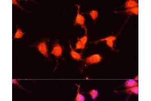 Immunofluorescence analysis of U-251MG cells using NGF Polyclonal Antibody at dilution of 1:100 (40x lens). (Nerve Growth Factor 抗体)