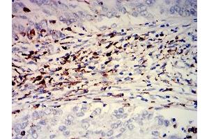 Immunohistochemistry (IHC) image for anti-CD274 (PD-L1) (AA 24-153) antibody (ABIN7193243)