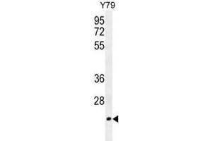 TCAL3 Antibody (N-term) western blot analysis in Y79 cell line lysates (35 µg/lane).