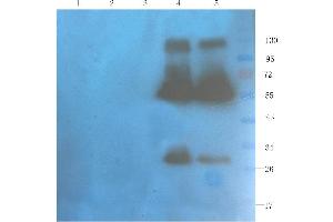 Western Blot using anti-OX40L antibody  Rat spleen (lane 1), rat muscle (lane 2), rat bladder (lane 3), human breast tumour (lane 4) and human thyroid tumour (lane 5) samples were resolved on a 10% SDS PAGE gel and blots probed with  at 1 µg/ml before being detected by a secondary antibody. (Recombinant CD40L (Ruplizumab Biosimilar) 抗体)