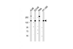 Western Blot at 1:1000 dilution Lane 1: A549 whole cell lysate Lane 2: DU145 whole cell lysate Lane 3: Hela whole cell lysate Lane 4: HT-1080 whole cell lysate Lysates/proteins at 20 ug per lane. (COL4A1 抗体  (N-Term))