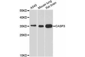 Western blot analysis of extracts of various cell lines, using CASP3 antibody. (Caspase 3 抗体  (AA 100-200))