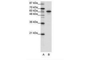Image no. 1 for anti-Cas-Br-M (Murine) Ecotropic Retroviral Transforming Sequence-Like 1 (CBLL1) (C-Term) antibody (ABIN202651)