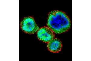 Confocal immunofluorescent analysis of RB1 Antibody  (ABIN1881730 and ABIN2840685) with MDA-M cell followed by Alexa Fluor 488-conjugated goat anti-rabbit lgG (green). (Retinoblastoma 1 抗体  (AA 586-615))