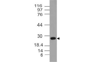 Image no. 1 for anti-14-3-3 theta (YWHAQ) antibody (ABIN5027747) (14-3-3 theta 抗体)