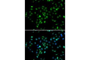 Immunofluorescence analysis of MCF7 cell using RBBP6 antibody. (RBBP6 抗体)