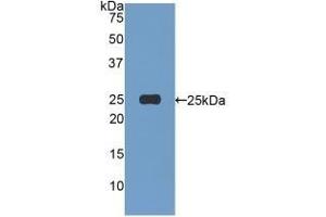 Detection of Recombinant AFM, Human using Polyclonal Antibody to Afamin (AFM) (Afamin 抗体  (AA 22-210))