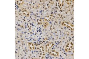 Immunohistochemistry of paraffin-embedded rat kidney using DiMethyl-Histone H3-K79 antibody (ABIN1873007) at dilution of 1:200 (40x lens).