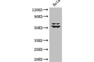Western Blot Positive WB detected in: Hela whole cell lysate All lanes: KLF5 antibody at 3 μg/mL Secondary Goat polyclonal to rabbit IgG at 1/50000 dilution Predicted band size: 51, 34, 19, 42 kDa Observed band size: 51, 60 kDa (KLF5 抗体  (AA 69-346))