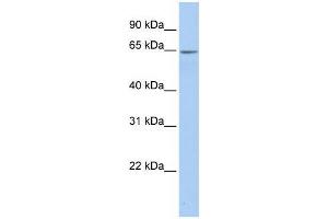 Human Placenta; WB Suggested Anti-ARSE Antibody Titration: 0. (Arylsulfatase E 抗体  (Middle Region))