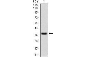 Western blot analysis using IL2RA mAb against human IL2RA recombinant protein.