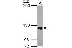 WB Image Sample (30 ug of whole cell lysate) A: HeLa 5% SDS PAGE antibody diluted at 1:5000 (PTPN12 抗体  (N-Term))