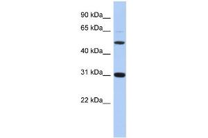 WB Suggested Anti-PI16 Antibody Titration: 0. (PI16 抗体  (Middle Region))