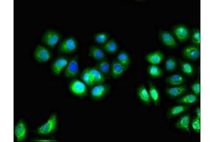 Immunofluorescent analysis of A549 cells using ABIN7156764 at dilution of 1:100 and Alexa Fluor 488-congugated AffiniPure Goat Anti-Rabbit IgG(H+L) (IL1RN 抗体  (AA 22-235))