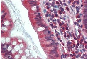 Human Small Intestine: Formalin-Fixed, Paraffin-Embedded (FFPE) (CA1 抗体  (AA 166-176))
