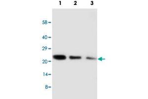 Western blot analysis of CDC42 recombinant protein with CDC42 polyclonal antibody . (CDC42 抗体  (Internal Region))
