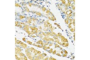Immunohistochemistry of paraffin-embedded human stomach using HSPA9 antibody. (HSPA9 抗体  (AA 380-679))